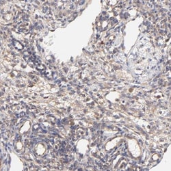 NDUFV3 Antibody, Novus Biologicals:Antibodies:Primary Antibodies